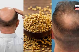 টাক মাথায় চুল গজাবে হুড়হুড়িয়ে... রান্নাঘরে থাকা এই ছোট্ট হলুদ দানা দিয়েই চুল গজাবে