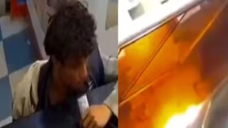 মোবাইলের লিথিয়াম ব্যাটারি কামড়ে দিতেই বিস্ফোরণ কিশোরের মুখে! 