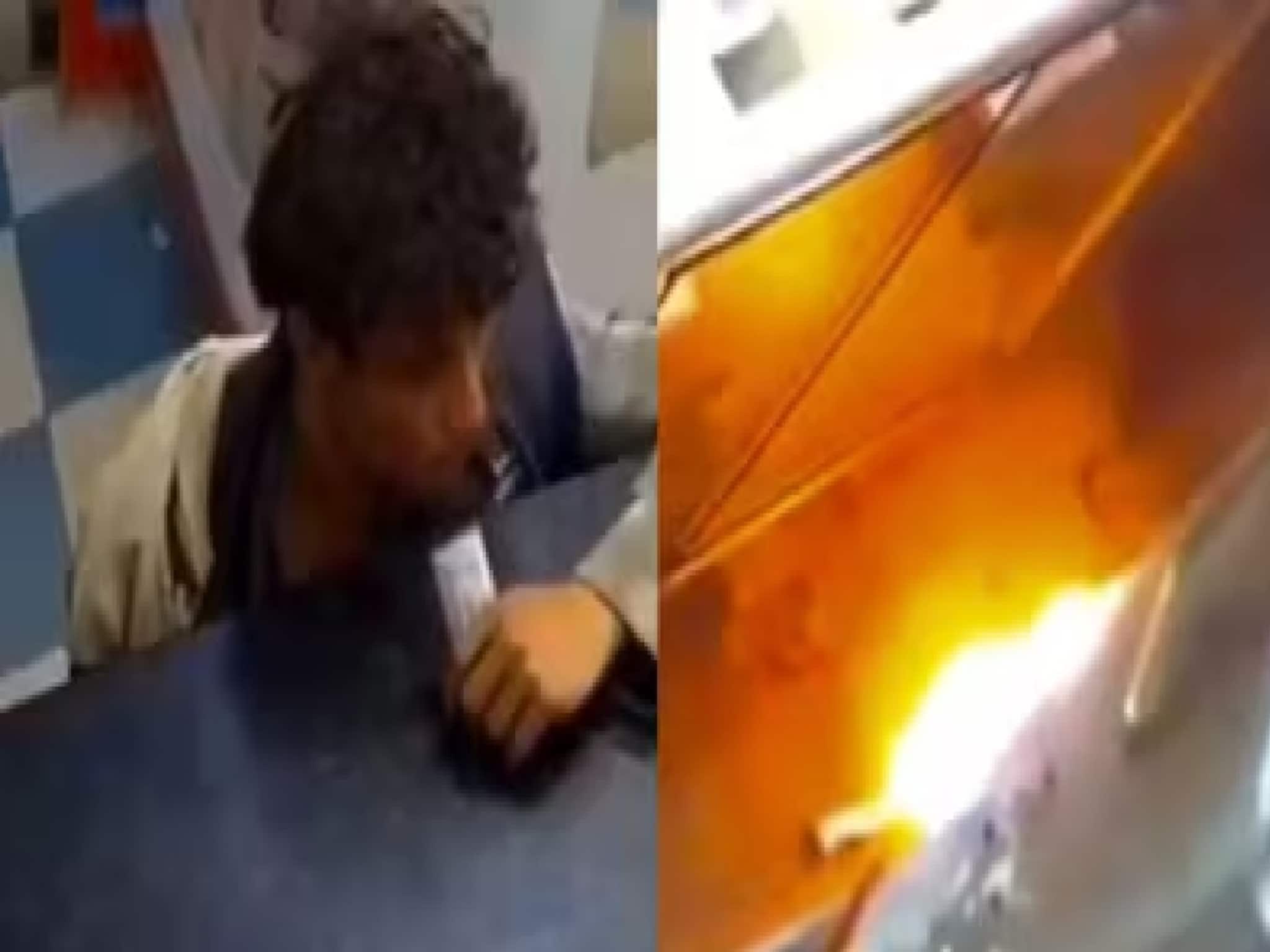 মোবাইলের দোকানে ঢুকে লিথিয়াম ব্যাটারিতে কামড়! কিশোরের মুখের মধ্যেই বিকট বিস্ফোরণ!