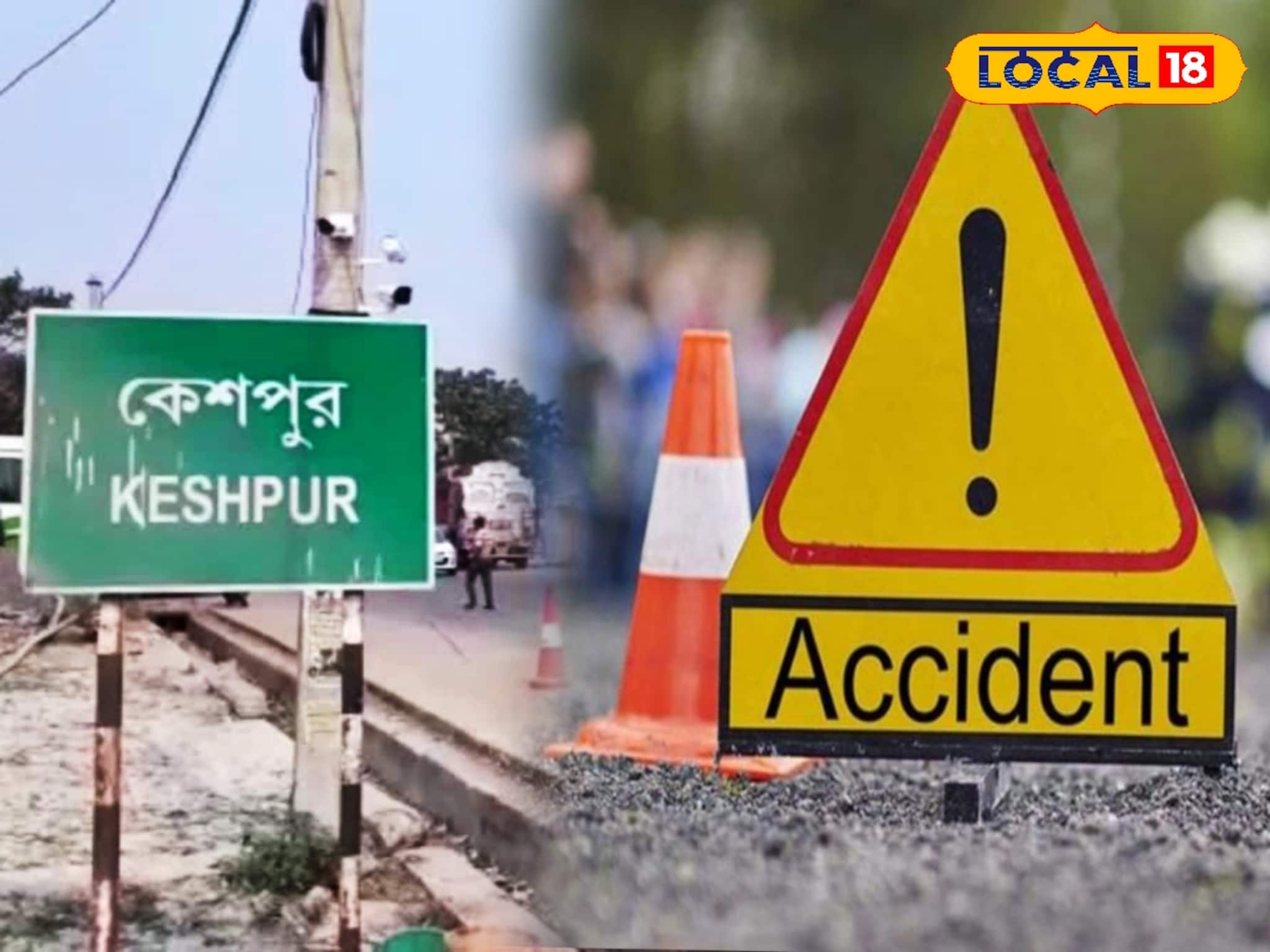 মাধ্যমিক দিতে যাওয়ার পথে ভয়াবহ দুর্ঘটনা! ভেঙে চুরমার স্বপ্ন, হাসপাতালে পরীক্ষার্থী মাধ্যমিক দিতে যাওয়ার পথে ভয়াবহ দুর্ঘটনা! ভেঙে চুরমার স্বপ্ন, হাসপাতালে পরীক্ষার্থী