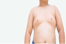 Gynecomastia: অনেক পুরুষই বড় স্তনের কারণে অস্বস্তিতে ভোগেন, অবসাদ নয়, জেনে নিন 'গাইনেকোমাস্টিয়া' কী, কীভাবে এই সমস্যা মেটাবেন