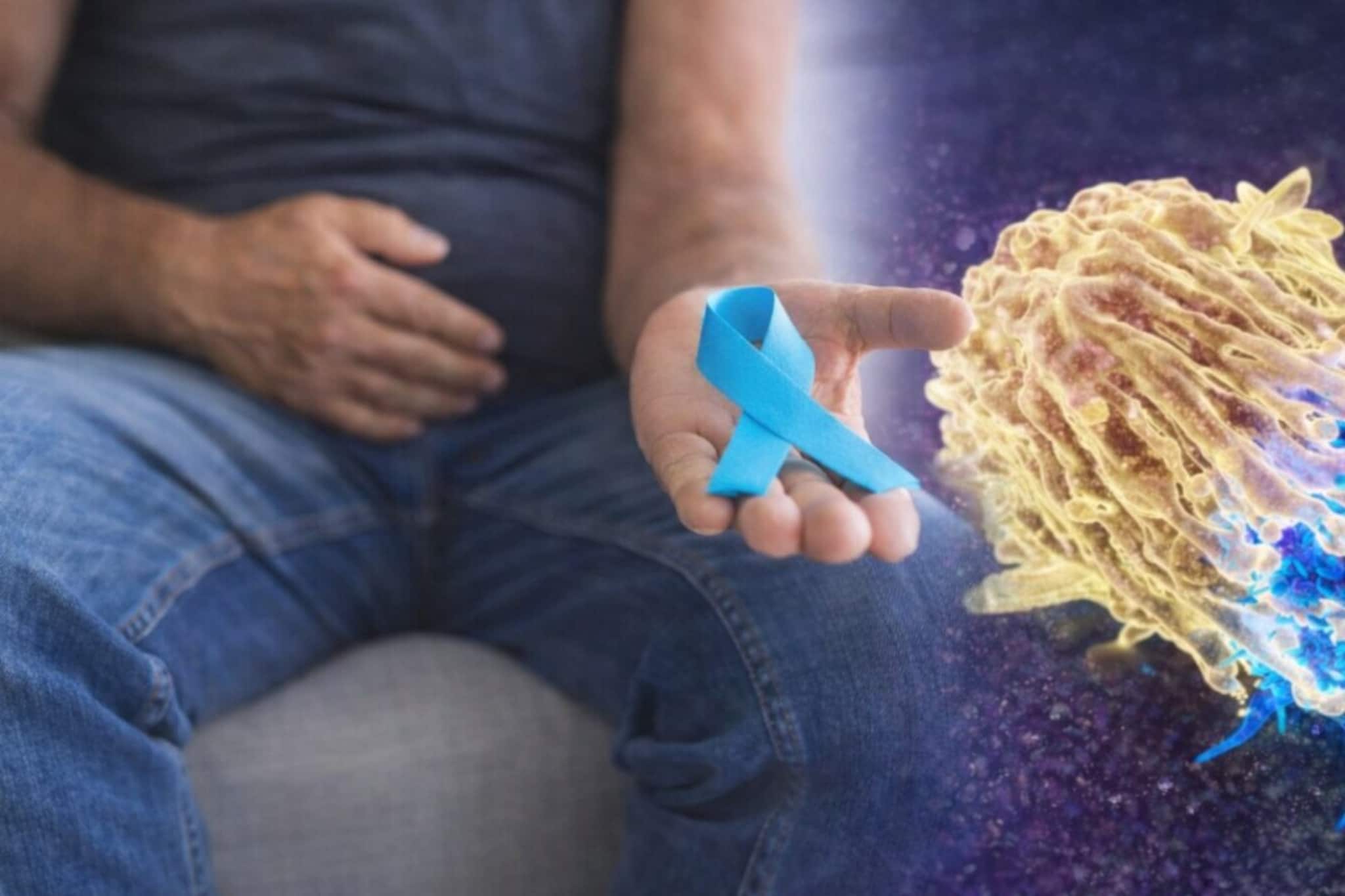 Weak Urine Flow Or Frequent Night Peeing? 5 Silent Prostate Cancer Signs You Should Never Ignore