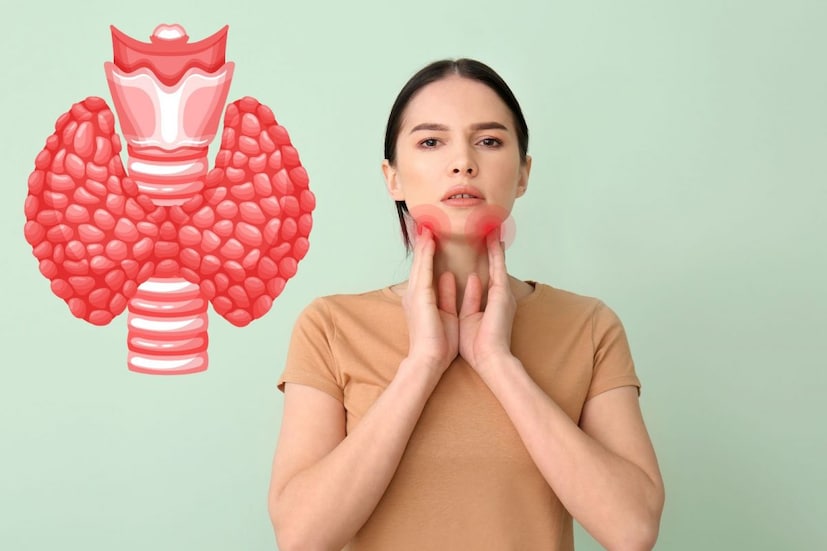 *থাইরয়েডের সমস্যা বর্তমানে মহিলাদের মধ্যে সবচেয়ে সাধারণ স্বাস্থ্য সমস্যাগুলির মধ্যে একটি। থাইরয়েড, আমাদের গলায় অবস্থিত একটি ছোট গ্রন্থি, শরীরের বিপাক এবং হরমোনের ভারসাম্য নিয়ন্ত্রণ করে। এই গ্রন্থি খুব বেশি (হাইপারথাইরয়েড) হরমোন তৈরি করলে বা খুব কম (হাইপোথাইরয়েড) হরমোন তৈরি করলে, অনেক স্বাস্থ্য সমস্যা দেখা দিতে পারে। সংগৃহীত ছবি। *থাইরয়েডের সমস্যা বর্তমানে মহিলাদের মধ্যে সবচেয়ে সাধারণ স্বাস্থ্য সমস্যাগুলির মধ্যে একটি। থাইরয়েড, আমাদের গলায় অবস্থিত একটি ছোট গ্রন্থি, শরীরের বিপাক এবং হরমোনের ভারসাম্য নিয়ন্ত্রণ করে। এই গ্রন্থি খুব বেশি (হাইপারথাইরয়েড) হরমোন তৈরি করলে বা খুব কম (হাইপোথাইরয়েড) হরমোন তৈরি করলে, অনেক স্বাস্থ্য সমস্যা দেখা দিতে পারে। সংগৃহীত ছবি।