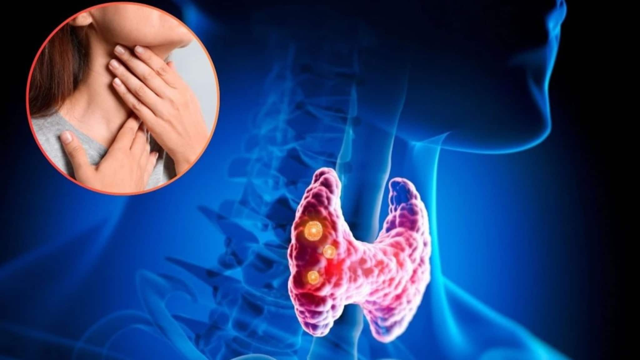 Battle Hypothyroidism: পুরুষদের তুলনায় মহিলাদের হাইপোথাইরয়েডিজম-এর ঝুঁকি ৫ গুণ বেশি, কীভাবে নিজেকে বাঁচাবেন? জানাচ্ছেন এন্ডোক্রিনোলজিস্ট