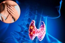 Battle Hypothyroidism: পুরুষদের তুলনায় মহিলাদের হাইপোথাইরয়েডিজম-এর ঝুঁকি ৫ গুণ বেশি, কীভাবে নিজেকে বাঁচাবেন? জানাচ্ছেন এন্ডোক্রিনোলজিস্ট