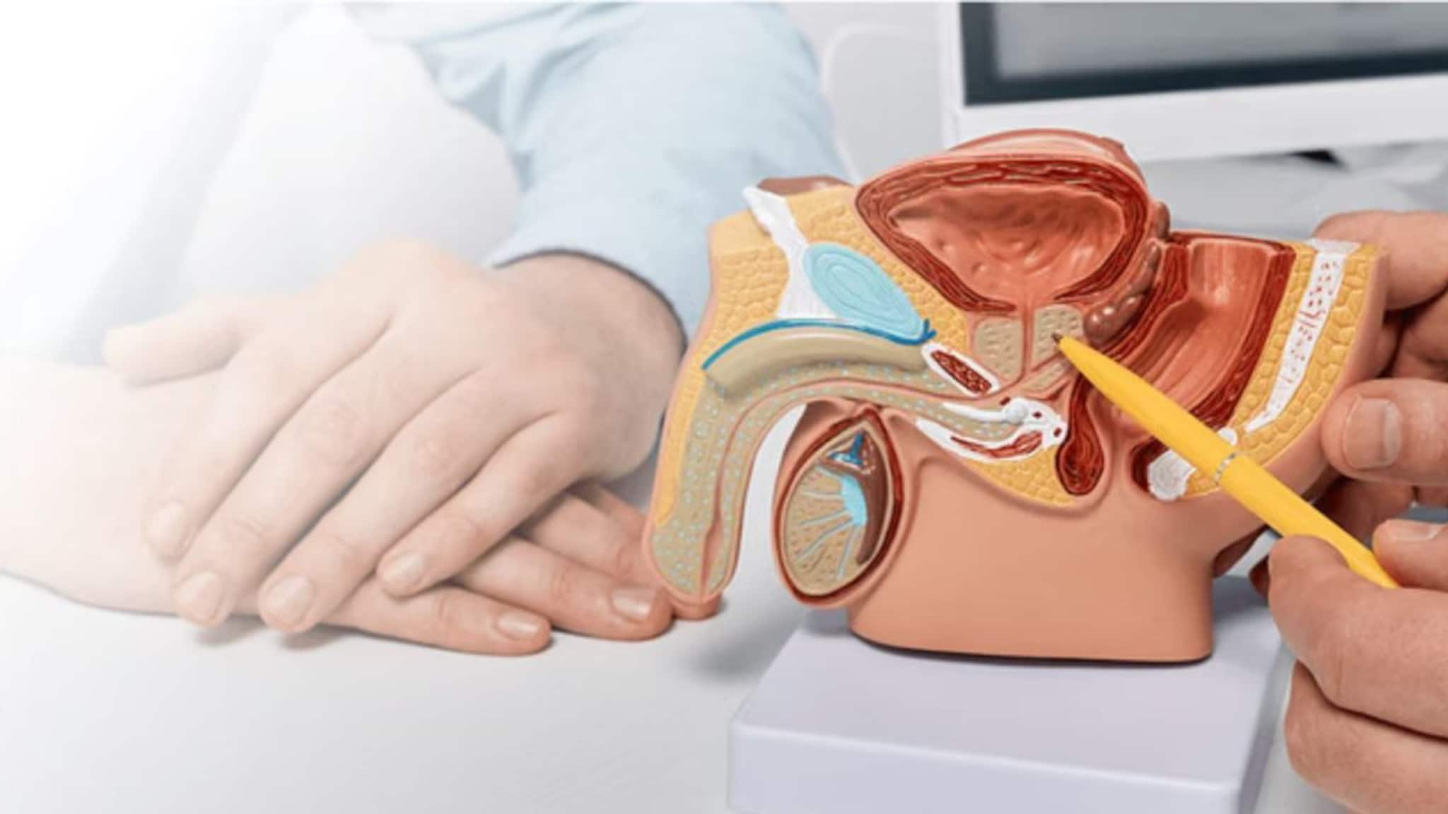 Prostate Cancer: 'এটি'ও প্রস্টেট ক্যানসারের লক্ষণ! পরিবারের কারও শরীরে দেখা গেলে আজই চিকিৎসা শুরু করুন