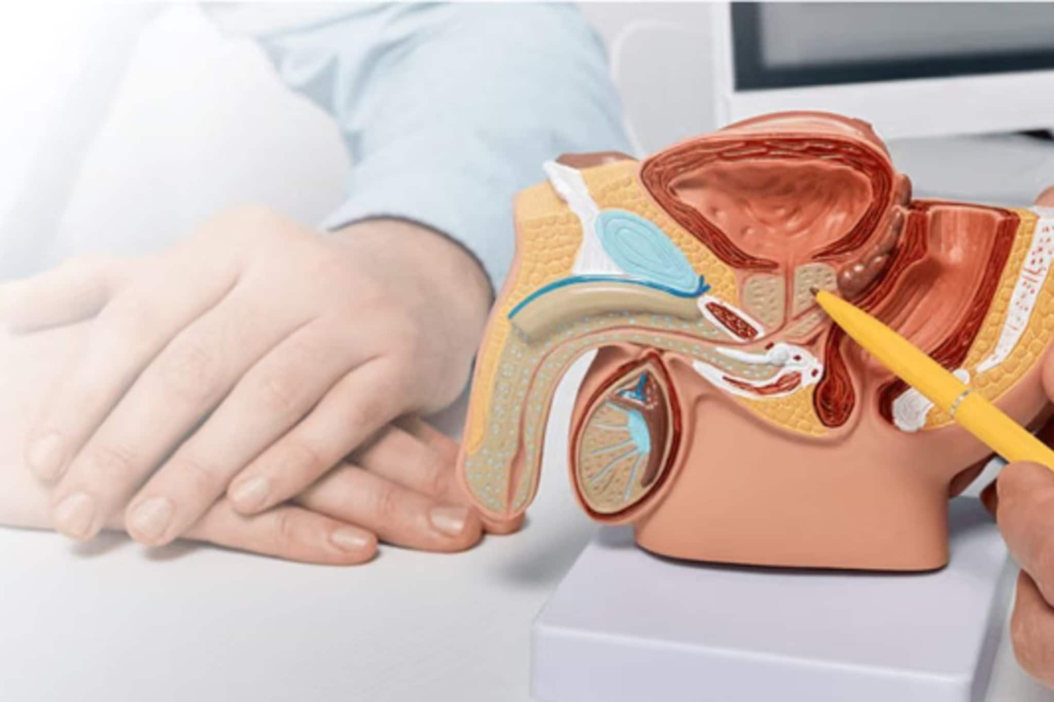 'এটি'ও প্রস্টেট ক্যানসারের লক্ষণ! পরিবারের কারও শরীরে দেখা গেলে আজই চিকিৎসা শুরু করুন