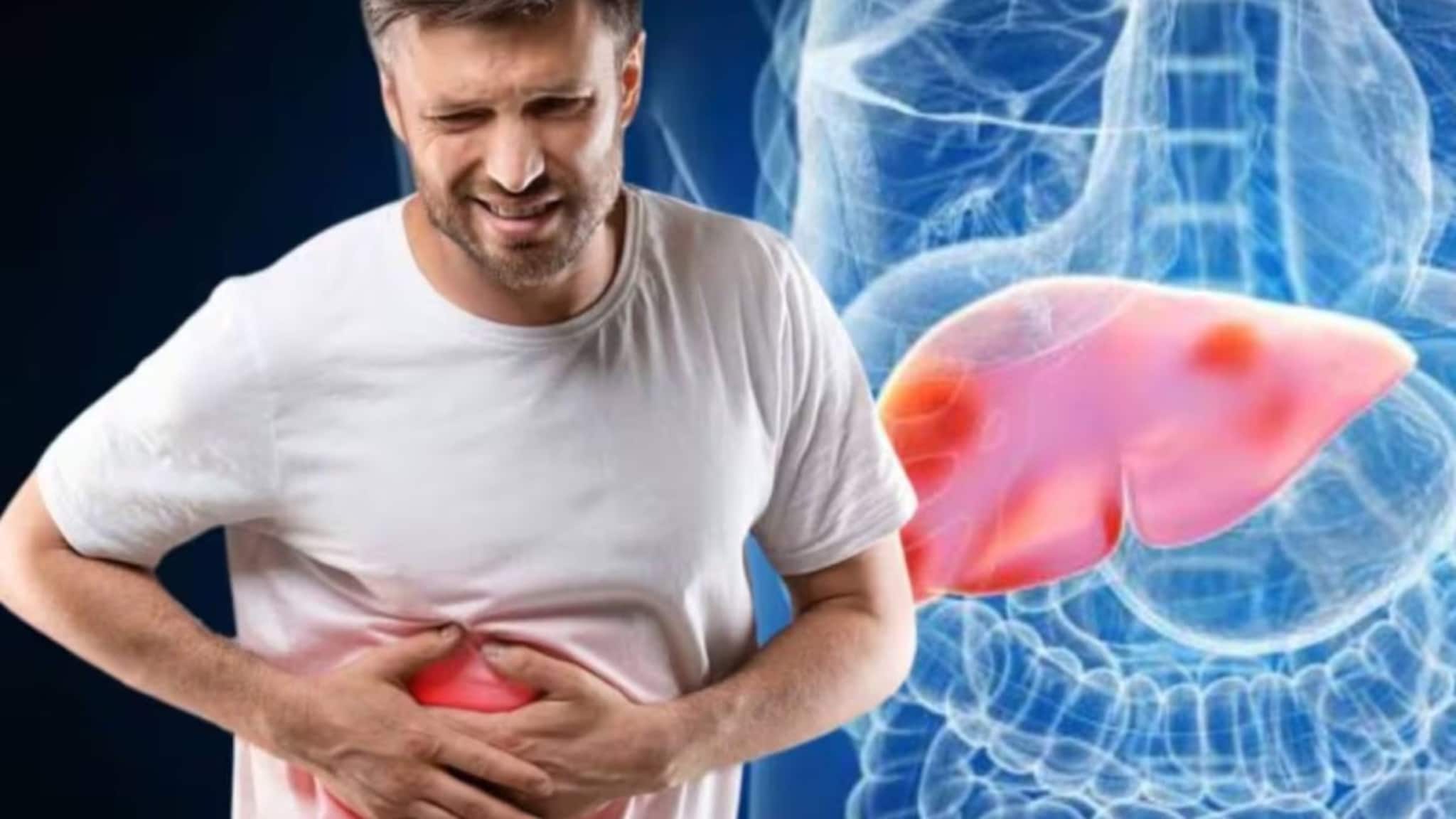 Liver Disease Symptoms: যদি চোখে 'এই' লক্ষণ দেখেন, এটা কিন্তু লিভার ক্যানসারও হতে পারে! আজই চিকিৎসকের কাছে যান