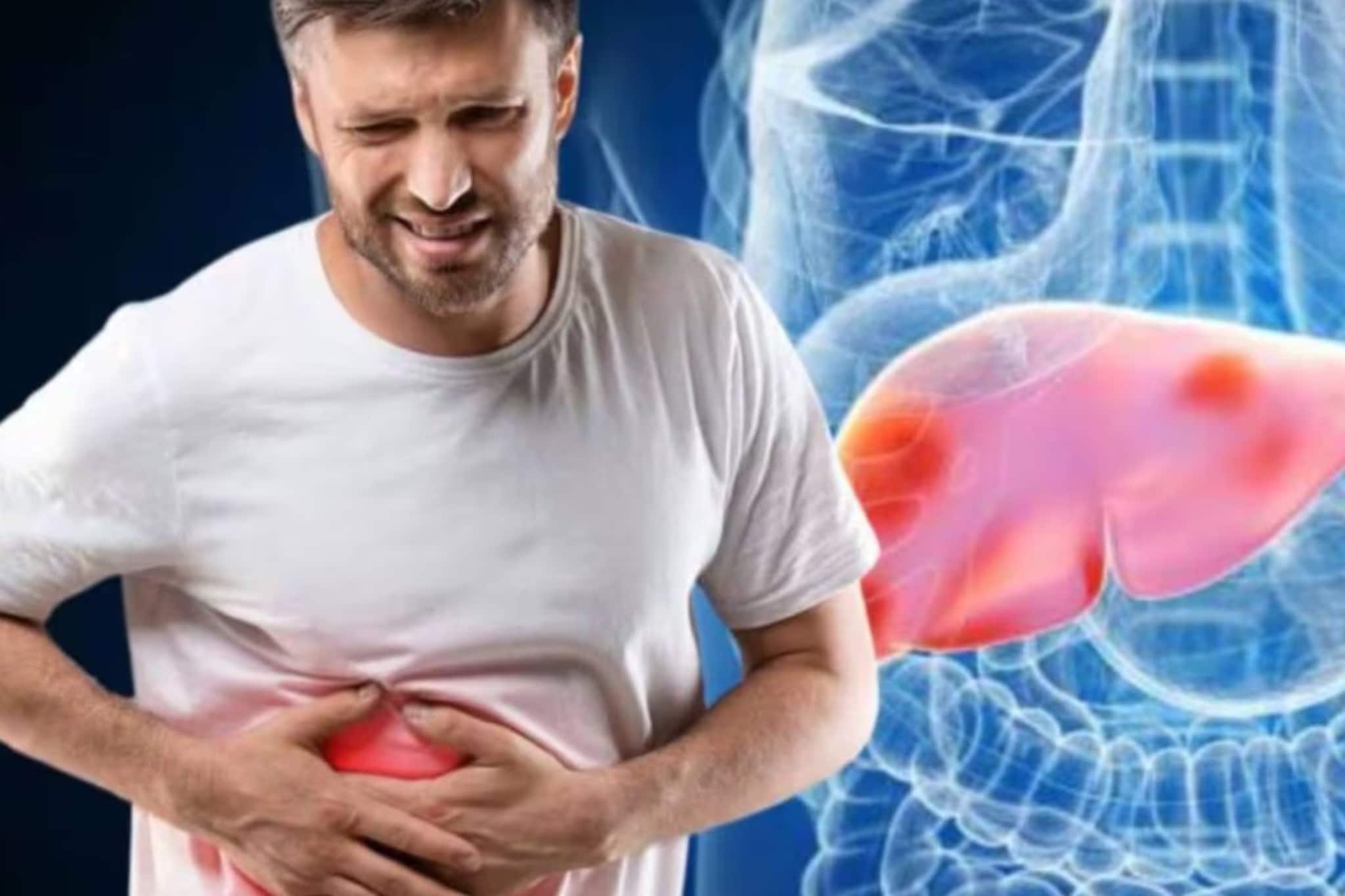 যদি চোখে 'এই' লক্ষণ দেখেন, এটা কিন্তু লিভার ক্যানসারও হতে পারে! আজই চিকিৎসকের কাছে যান