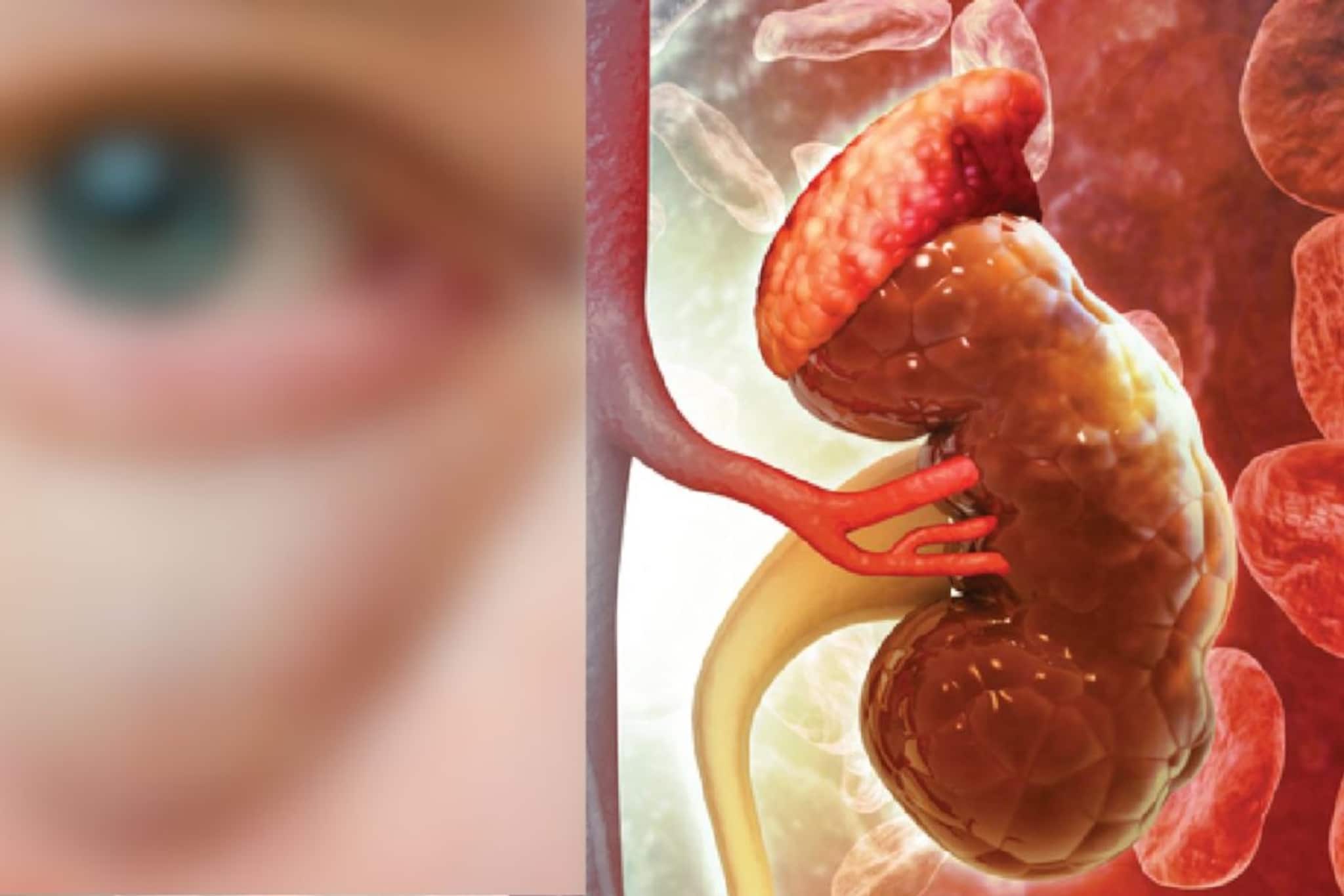 মুখ দেখেই বোঝা যায় পচছে কিডনি! যদি শরীরে 'এই' লক্ষণ দেখা দেয়, মৃত্যুও হতে পারে! আজই চিকিৎসকের কাছে যান