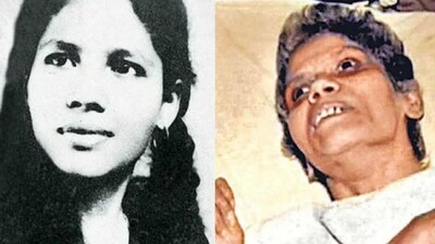 Aruna Shanbaug: 42 Years in PVS, Her Euthanasia Case Shaped India's Right to Die Law