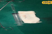 Burdwan Medical College: বিস্কুট খেয়ে মৃত্যুর মুখে! খাদ্যনালীতে তার আটকে কেলেঙ্কারি, বর্ধমান মেডিক্যালে জটিল অস্ত্রোপচারে ব্যক্তির প্রাণরক্ষা