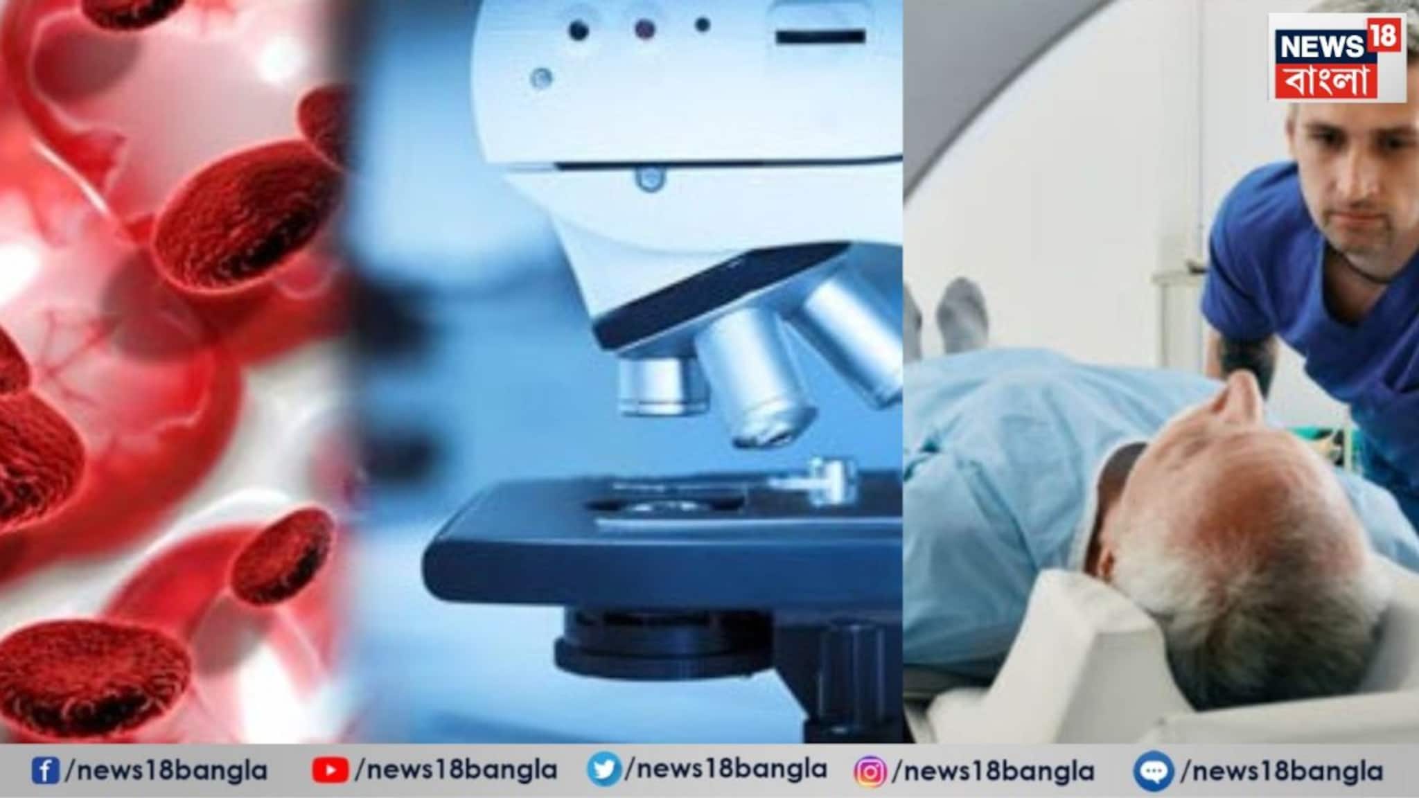 Cancer Test: একবার হলেই শরীরে ছড়িয়ে পড়ে হুহু করে, সময়মতো 'এই' টেস্টগুলো করালে ক্যানসার আটকাতে পারবেন