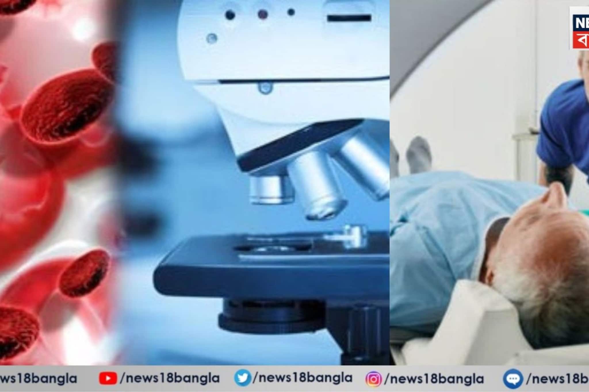 একবার হলেই শরীরে ছড়িয়ে পড়ে হুহু করে,সময়মতো 'এই' টেস্টগুলো করালে ক্যানসার আটকাতে পারবেন