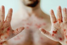 Chicken Pox: শীতশেষে হানা দেয় 'চিকেন পক্স', এই ভয়ঙ্কর কষ্টদায়ক রোগ থেকে বাঁচায় যে ৪ সবজি