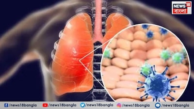 এই সিকাডা ভ্যারিয়েন্টটি মার্কিন যুক্তরাষ্ট্রের কয়েকটি রাজ্যসহ বিশ্বের ২২টি দেশে ছড়িয়ে পড়েছে এবং দ্রুত সংক্রমিত করছে।