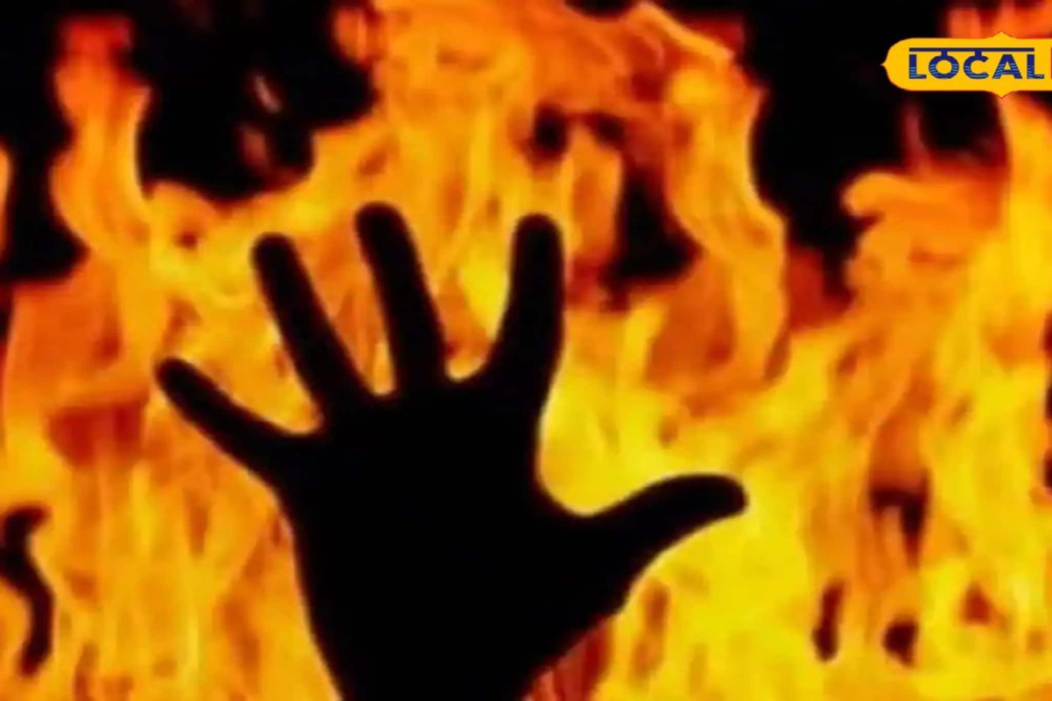 কোচবিহারে আগুনে পুড়ে সরকারি হাসপাতালের নার্সের রহস্য মৃত্যু! সন্দেহের তির আহত স্বামীর দিকে