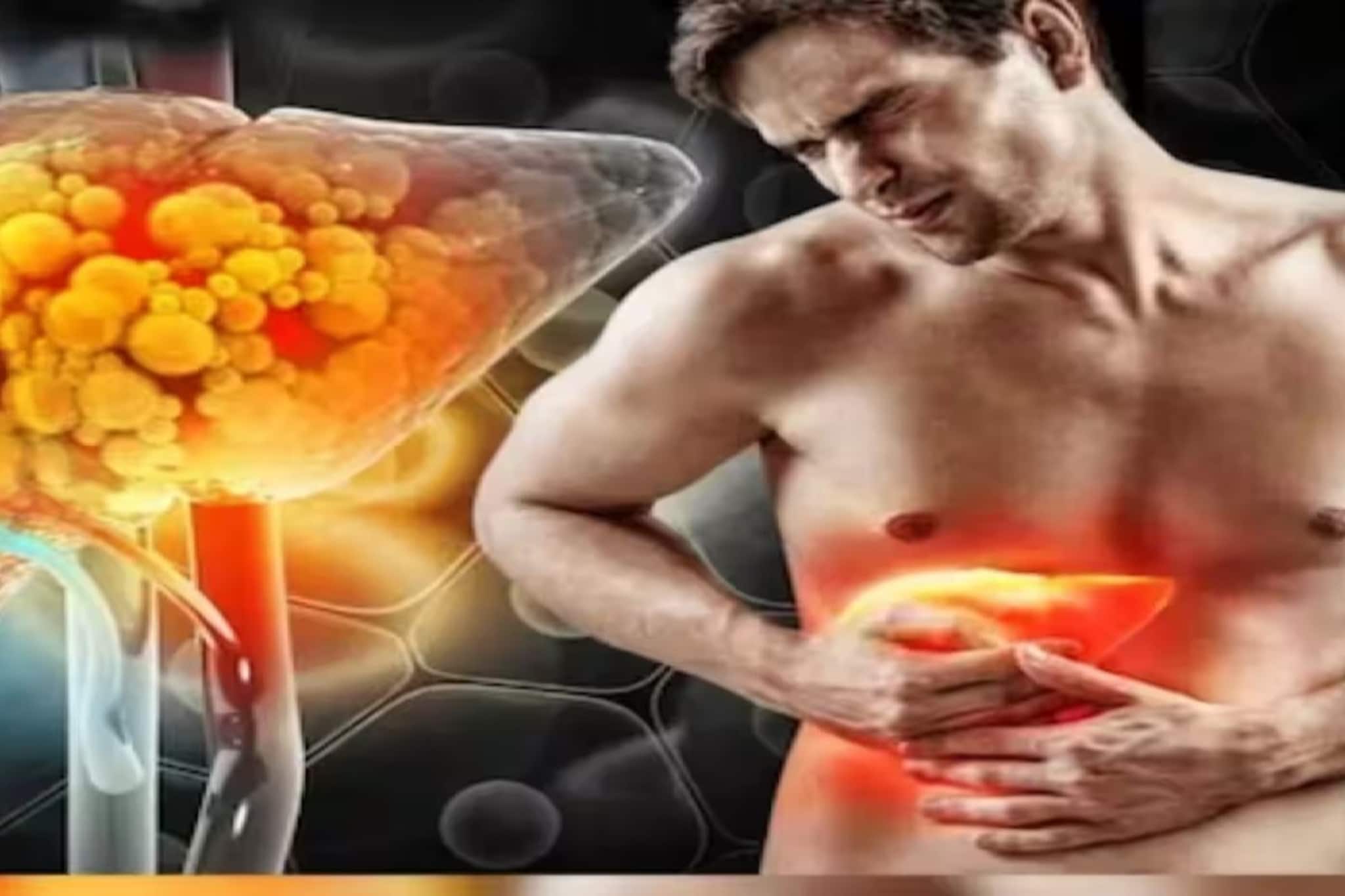  'ফ্যাটি লিভার ডিজিজ'-এ ভুগছেন? এক সস্তার ভিটামিনেই এই রোগ সারবে, গলবে লিভারের চর্বি! যা জানাচ্ছে গবেষণা