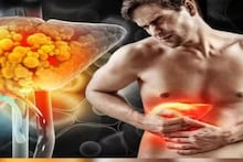 Vitamin for Fatty Liver: 'ফ্যাটি লিভার ডিজিজ'-এ ভুগছেন? এক সস্তার ভিটামিনেই এই রোগ সারবে, গলবে লিভারের চর্বি! যা জানাচ্ছে গবেষণা