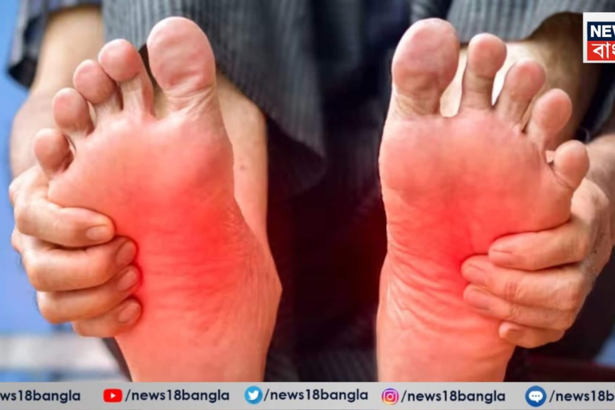 মাঝেমাঝে পায়ের পাতা জ্বালা করে? শরীরের এই অংশে বারোটা বাজছে, অবহেলা করবেন না