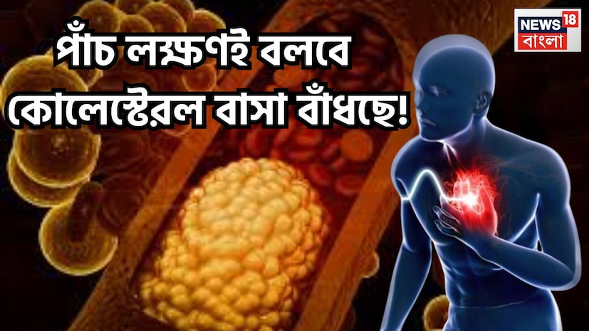 হাই কোলেস্টেরলকেই বলা হয়ে থাকে সাইলেন্ট কিলার, কিন্তু এর লক্ষণ সহজে বুঝতে পারা যায়না তবে ৷ যখন এর লক্ষণ শরীরে পড়ে ঠিক তখন অনেক দেরি হয়ে যায় ৷ প্রতীকী ছবি ৷ হাই কোলেস্টেরলকেই বলা হয়ে থাকে সাইলেন্ট কিলার, কিন্তু এর লক্ষণ সহজে বুঝতে পারা যায়না তবে ৷ যখন এর লক্ষণ শরীরে পড়ে ঠিক তখন অনেক দেরি হয়ে যায় ৷ প্রতীকী ছবি ৷