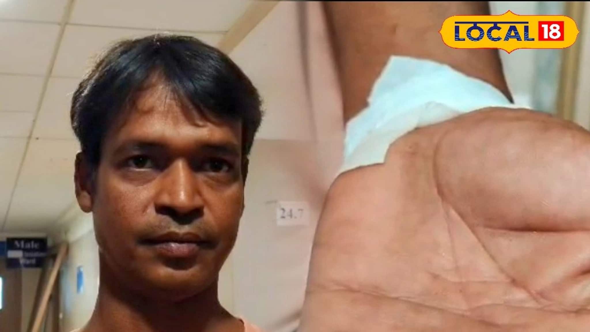 এ কি কাণ্ড! সাপের কামড় খেয়ে সাপ নিয়েই সোজা হাসপাতালে হাজির যুবক, তারপর যা হল...