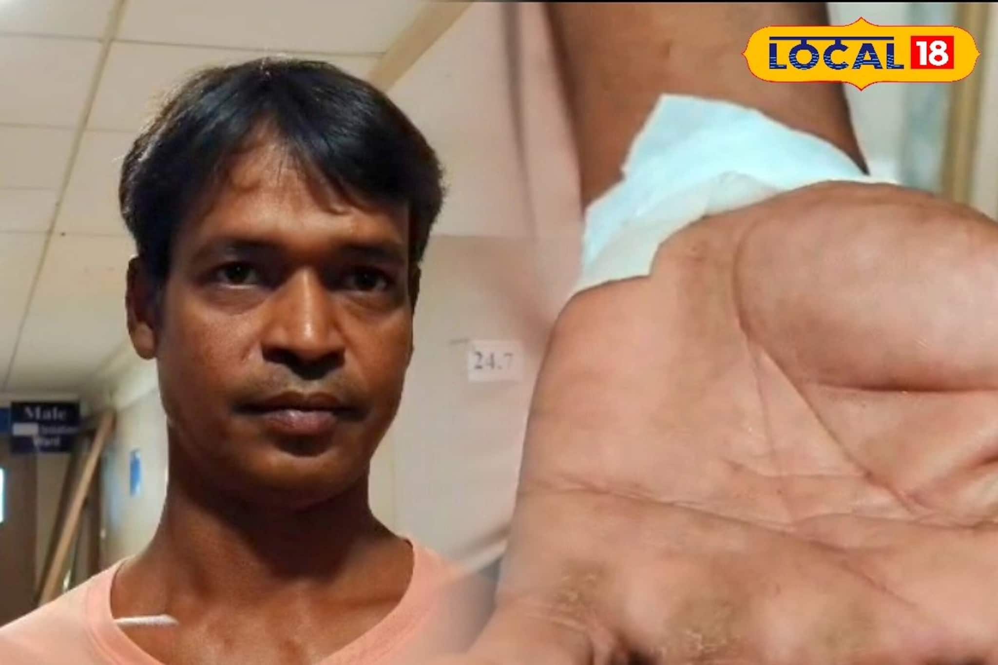 এ কি কাণ্ড! সাপের কামড় খেয়ে সাপ নিয়েই সোজা হাসপাতালে হাজির যুবক, তারপর যা হল...