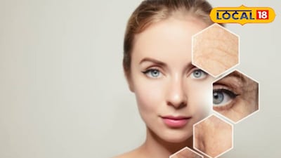 প্রতিকি ছবি