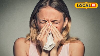 এলার্জি থেকে বাঁচার উপায় জানালেন চিকিৎসক