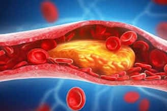 আগে থেকে কোলেস্টেরল নিয়ে সচেতন না হলে আঘাত হানতে পারে হৃদরোগ... আমেরিকার গবেষণায় ভয়াবহ ইঙ্গিত