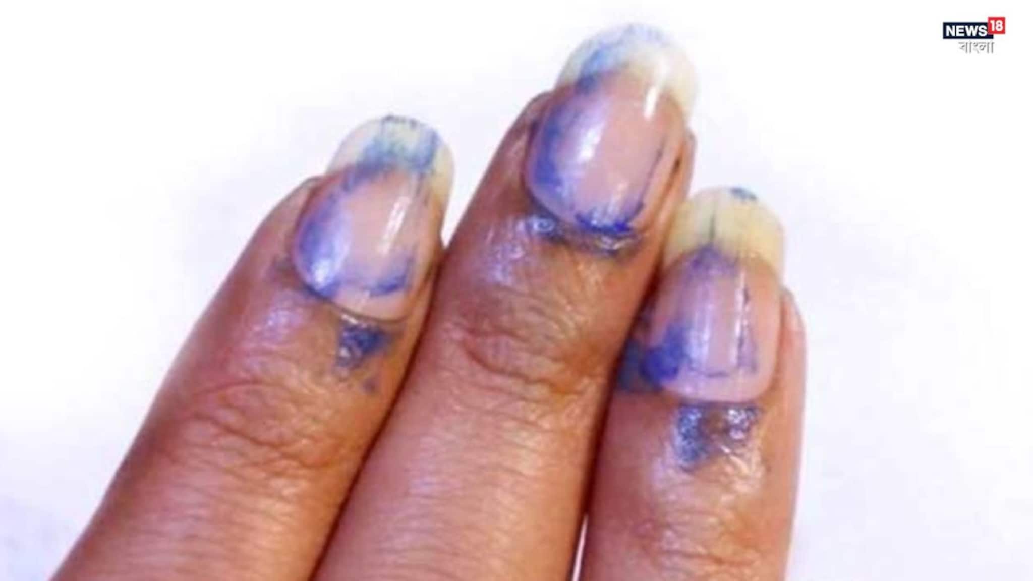 Holi Nail Care Tips: দোল খেলেছেন? নখের একগুঁয়ে রং তুলতে এই ঘরোয়া কৌশল মানুন