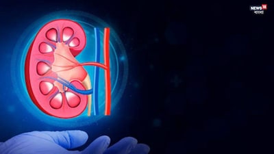 কিডনি প্রতিস্থাপন