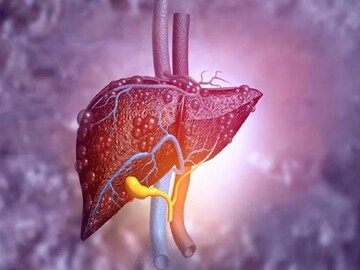 ব্লাড টেস্ট স্বাভাবিক বলে নিশ্চিন্ত? এই ভুল করবেন না! লিভারের অসুখ অনেকসময় রক্ত পরীক্ষায় ধরা পড়ে না, কোন উপসর্গ ভয়ের?