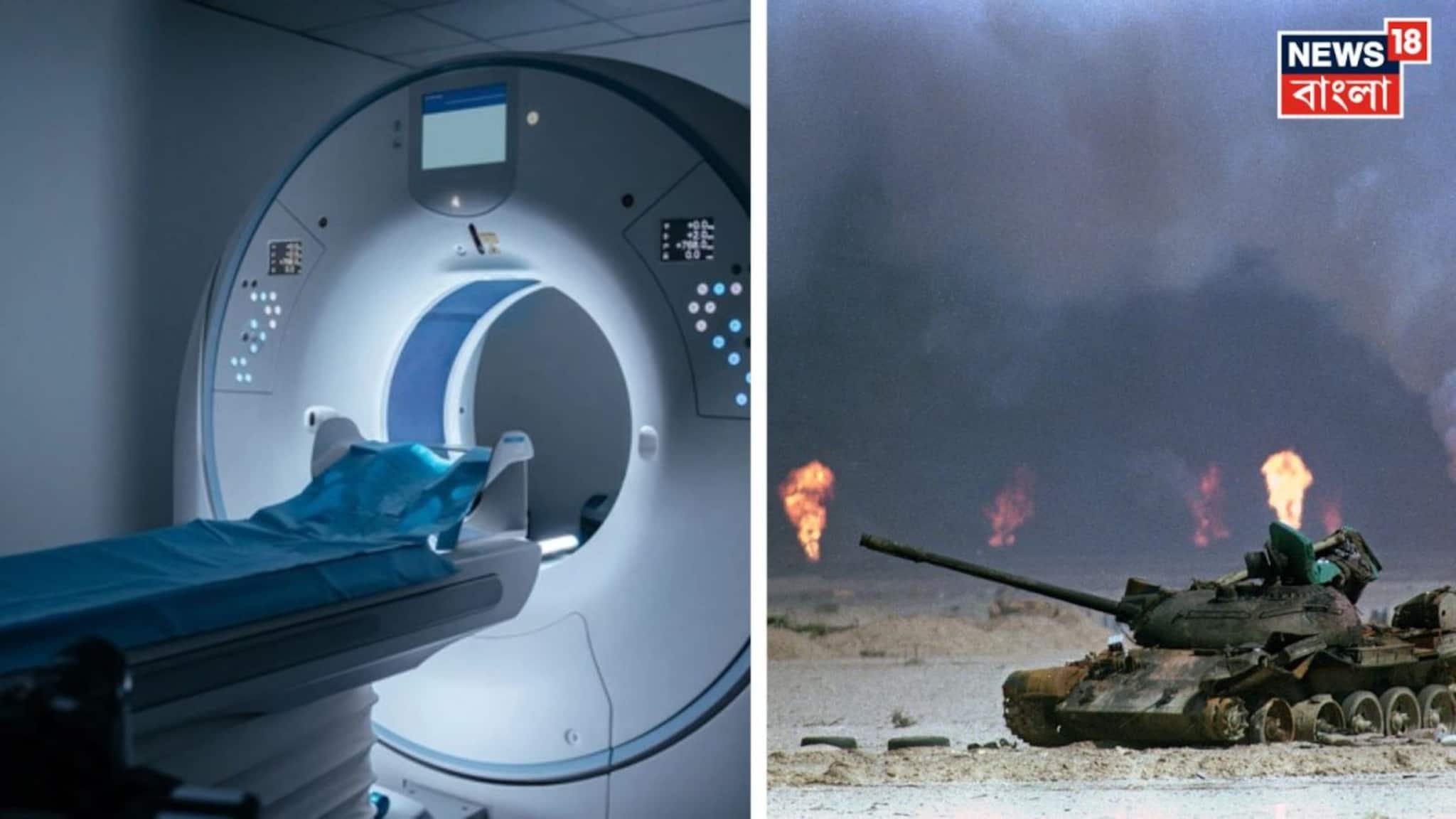 MRI Machine and Health Sector: ইরান-ইজরায়েল পরিস্থিতির মারাত্মক ধাক্কা, এবার স্বাস্থ্যক্ষেত্রে নড়ে যাবে সিস্টেম, বড় আপডেট হাসপাতালের থেকে