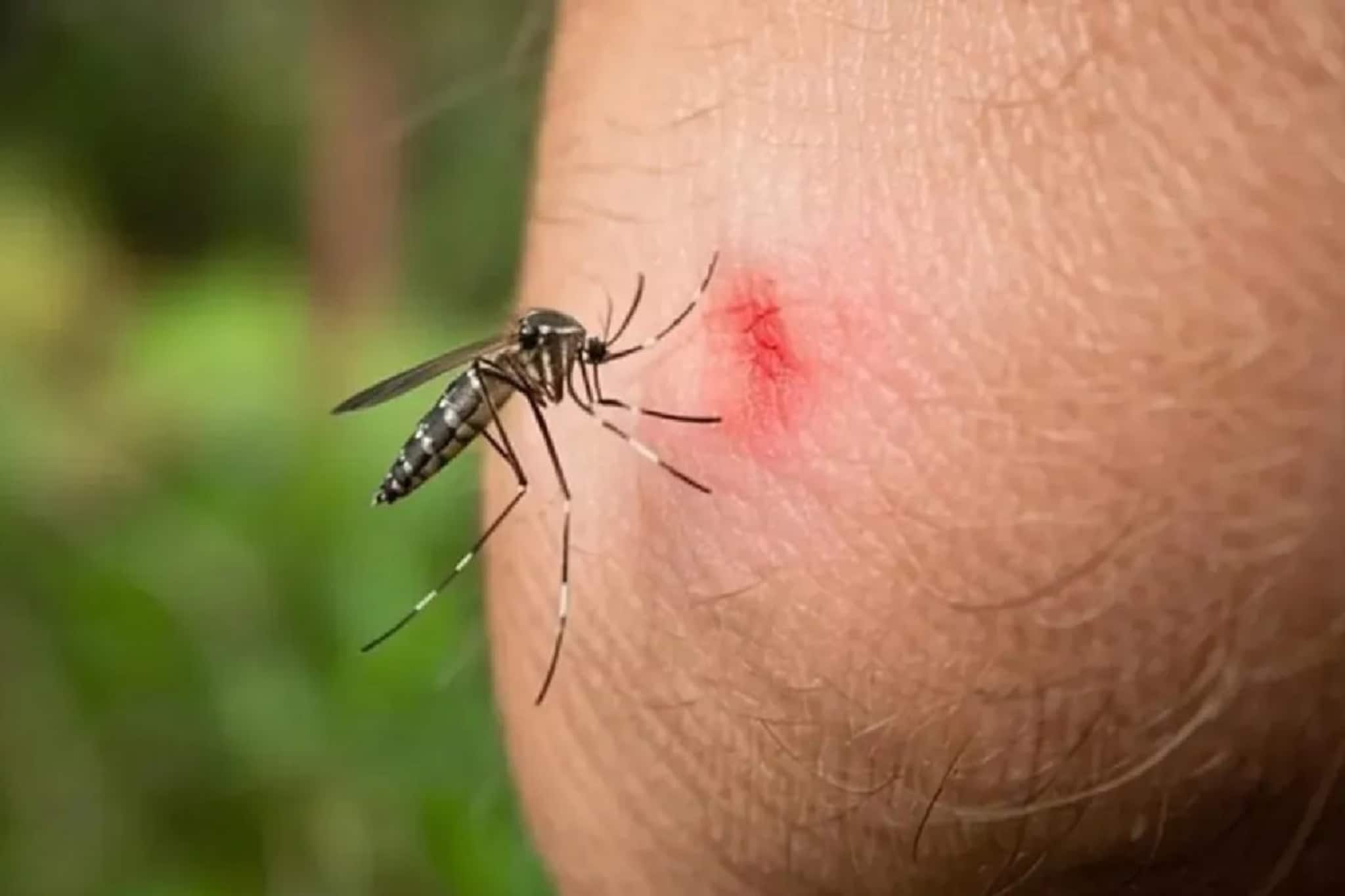 গরম পড়তেই মশার জ্বালায় অতিষ্ট, বাড়িতে থাকুক '৩' গাছের একটি, ঘরের ত্রিসীমানায় একটা মশাও আসবে না গরম পড়তেই মশার জ্বালায় অতিষ্ট, বাড়িতে থাকুক '৩' গাছের একটি, ঘরের ত্রিসীমানায় একটা মশাও আসবে না