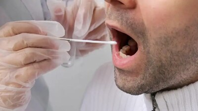 Symptoms of Oral Cancer