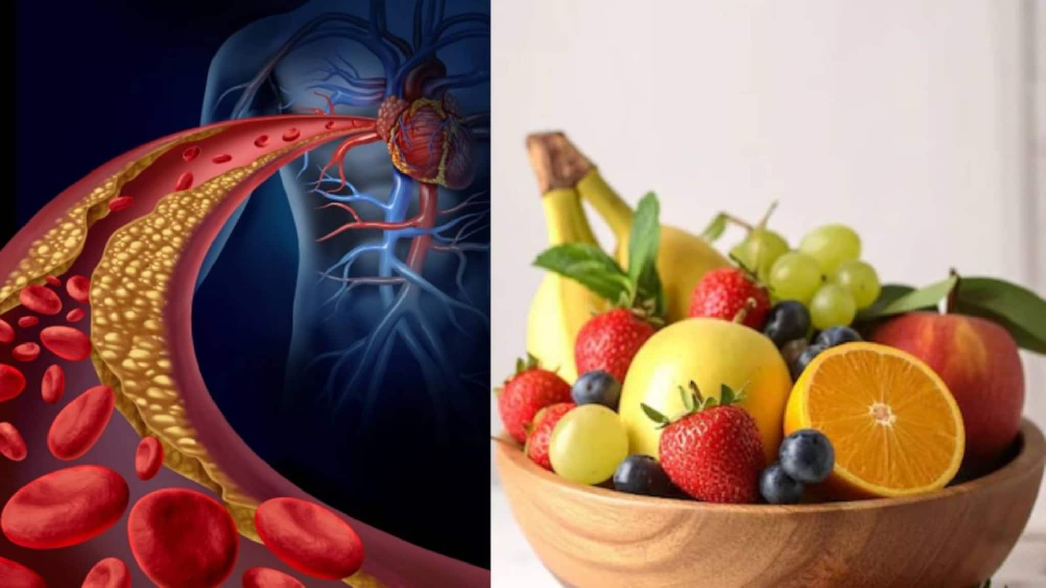 Fruits to control Cholesterol: ৫ ফলের পঞ্চবাণ! কোলেস্টেরল রোগীদের কাছে ওষুধের মতো! শিরা থেকে টেনে বার করে নোংরা ময়লা! অবিশ্বাস্য উপকারিতা!
