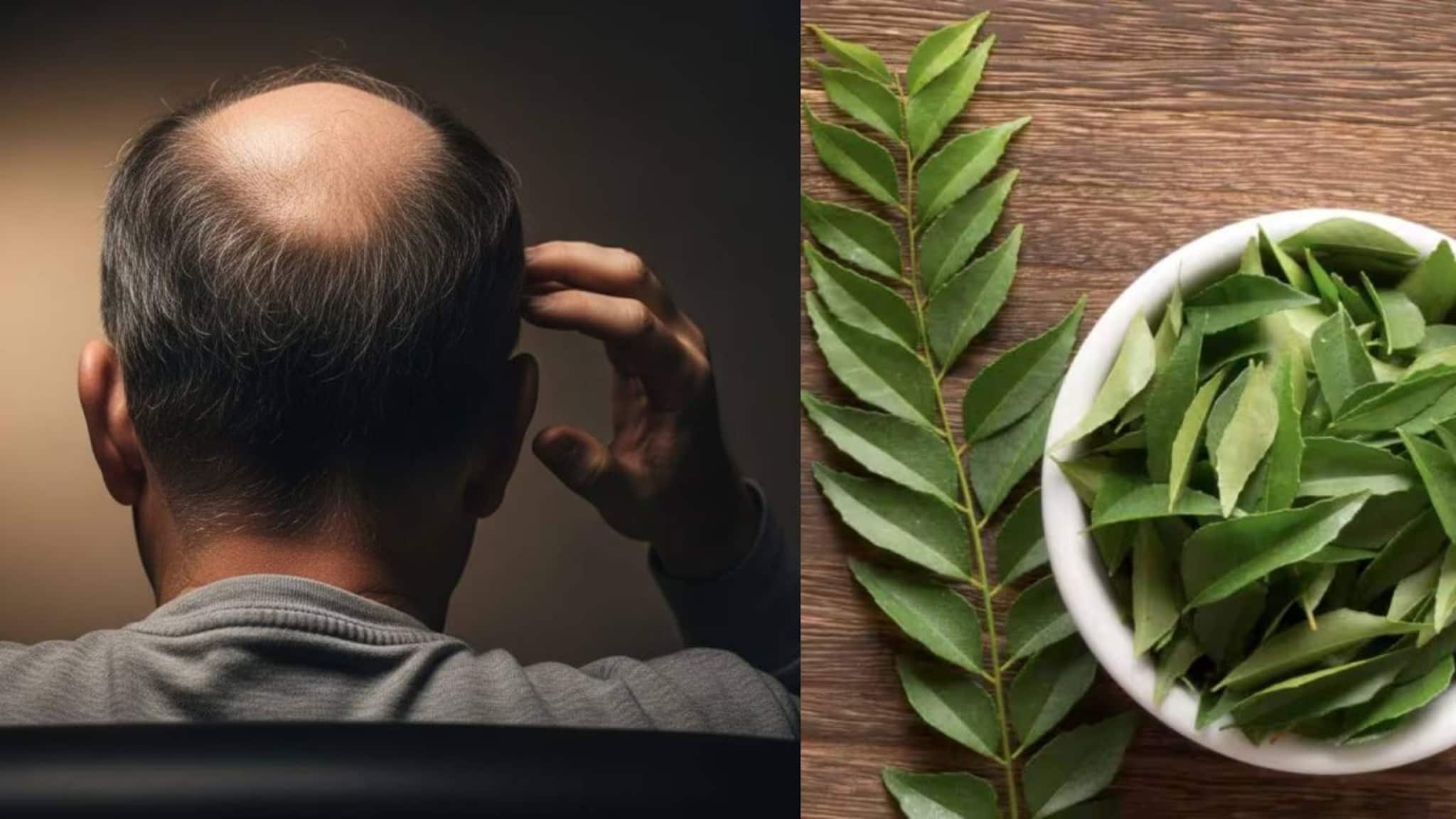 Baldness: মাথায় টাক পড়ছে? ১ মুঠো কারিপাতায় জাস্ট ২ টো জিনিস মিশিয়ে মাখলেই ধীরে ধীরে উধাও টাক! জন্মাবে নতুন চুল Baldness: মাথায় টাক পড়ছে? ১ মুঠো কারিপাতায় জাস্ট ২ টো জিনিস মিশিয়ে মাখলেই ধীরে ধীরে উধাও টাক! জন্মাবে নতুন চুল