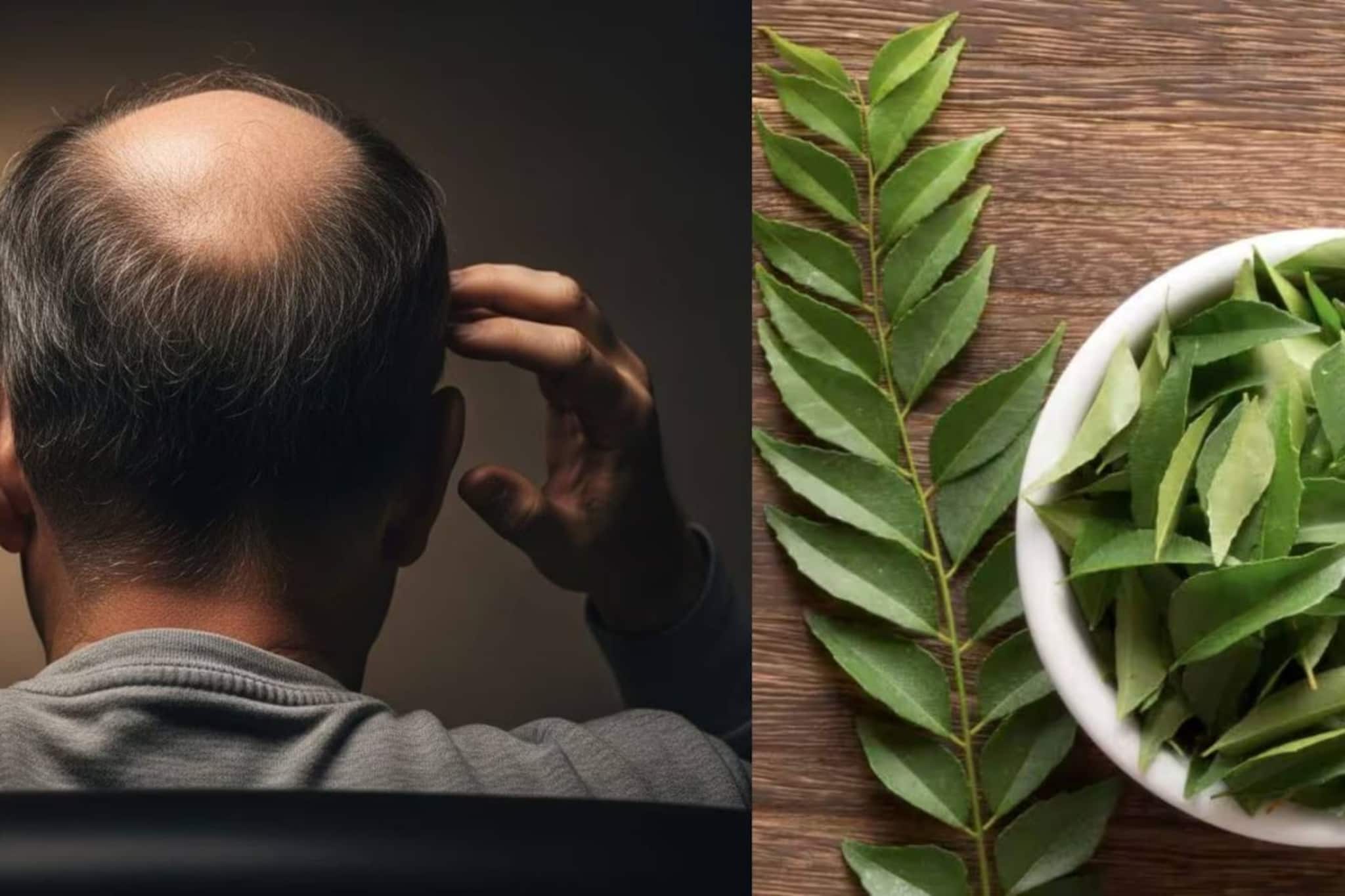 মাথায় টাক পড়ছে? ১ মুঠো কারিপাতায় জাস্ট ২ টো জিনিস মিশিয়ে মাখলেই ধীরে ধীরে উধাও টাক! জন্মাবে নতুন চুল 