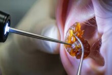 Ear Discharge: কান থেকে সাদা, হলুদ বা লাল স্রাব? দেরি না করে ছুটে যান চিকি‍ৎসকের কাছে...জানুন নিম-রসুনের ঘরোয়া টোটকাও