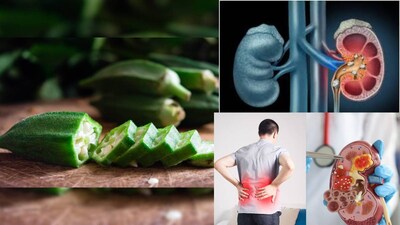 অন্যান্য অনেক সবজির মতো ঢেঁড়শেও উচ্চ মাত্রায় ফাইবার এবং অ্যান্টিঅক্সিডেন্ট থাকার কারণে এর স্বাস্থ্য উপকারিতা রয়েছে । তবে, অতিরিক্ত ঢেঁড়শ খেলে কিছু মানুষের ক্ষেত্রে বিরূপ প্রভাব পড়তে পারে। বলছেন বিশেষজ্ঞ মৃণাল শিরোদকর।