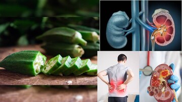 ঢেঁড়শ খেলেই কিডনিতে জমবে পাথরের পাহাড়? আর কোন কোন রোগে ভুলেও দাঁতে কাটবেন না এই সবজি? জানুন