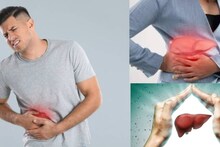 Fatty Liver Cure: ওষুধ ছাড়াই সারবে ফ্যাটি লিভার! ৩ খাবার বাদ দিয়ে ছোট্ট কাজেই লিভার থেকে সাফ দূষিত ময়লা! চরম জব্দ জটিল রোগ!