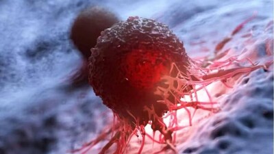 Fight Cancer with 5 Kitchen Superfoods: Boost Your Health Today!