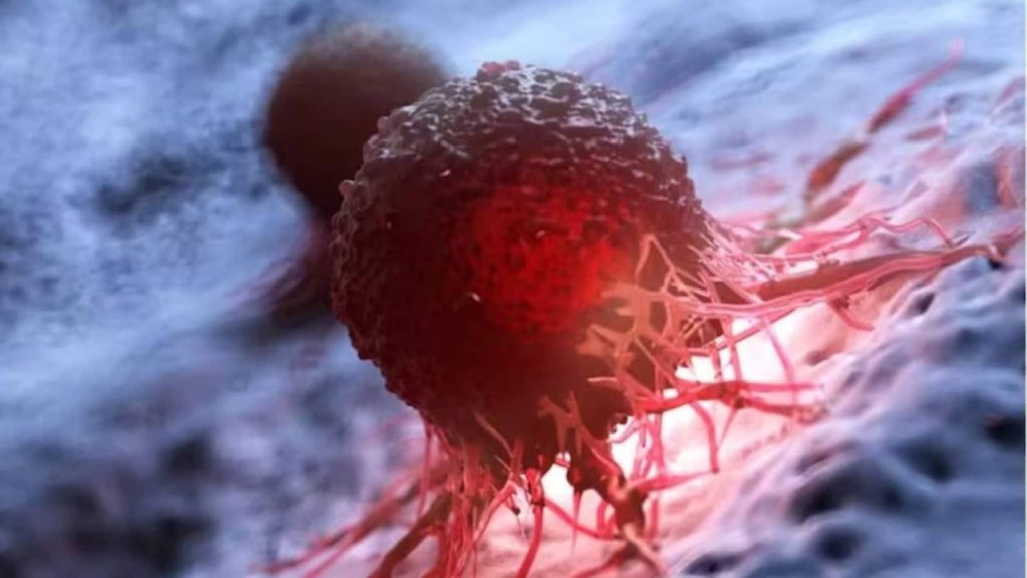 Superfood to Prevent Cancer: রান্নাঘরের ৫ সুপারফুড! সস্তা খাবারই রুখে দেয় ক্যানসার! আজই শুরু করুন খেতে!