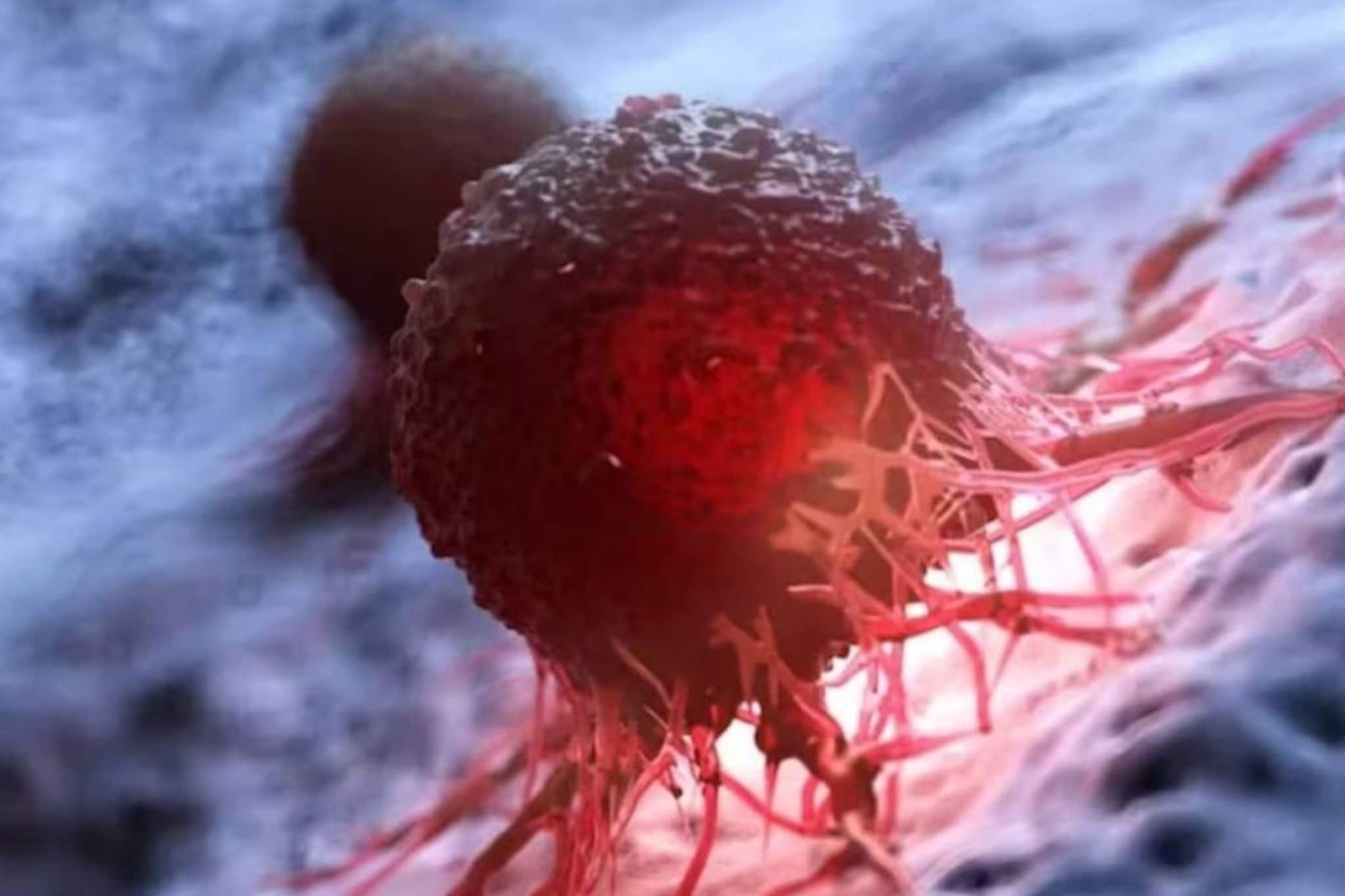 রান্নাঘরের ৫ সুপারফুড! সস্তা খাবারই রুখে দেয় ক্যানসার! আজই শুরু করুন খেতে! রান্নাঘরের ৫ সুপারফুড! সস্তা খাবারই রুখে দেয় ক্যানসার! আজই শুরু করুন খেতে!