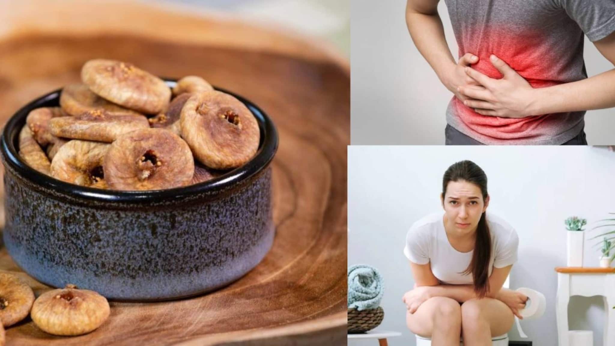 Constipation & Indigestion: ২ টো শুকনো ডুমুর ‘এভাবে’ খেলেই পেটের নোংরা সাফ গলগলিয়ে! রেহাই গ্যাস-অম্বল-বদহজম থেকেও
