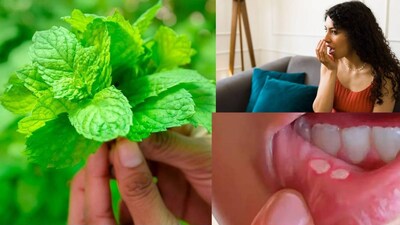 গ্রীষ্ম শুরু হয়ে গেছে। এর সঙ্গে ঘরে ঘরে পুদিনার ব্যবহারও বেড়েছে। পুদিনা সাধারণত চাটনি বা স্যালাডে ব্যবহৃত হয়। তবে, বিন্ধ্য অঞ্চলে এটি ঔষধি হিসেবেও ব্যবহৃত হয়। প্রাচীনকাল থেকেই পুদিনা ঘরোয়া প্রতিকার হিসেবে ব্যবহৃত হয়ে আসছে। পুদিনা একটি প্রাকৃতিক শীতলকারী হিসেবে পরিচিত, যা কেবল শরীরকে শীতল করে না বরং অনেক স্বাস্থ্য সমস্যার জন্যও উপকারী বলে বিবেচিত হয়। গ্রীষ্মকালে মানুষ এটি প্রচুর পরিমাণে গ্রহণ করে।