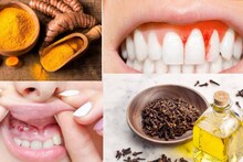 Pyorrhea Home Remedies: দাঁত ব্রাশ করার সময় মাড়ি থেকে গলগলিয়ে রক্ত? ১ চিমটে হলুদের কামালে নির্বংশ পায়োরিয়া