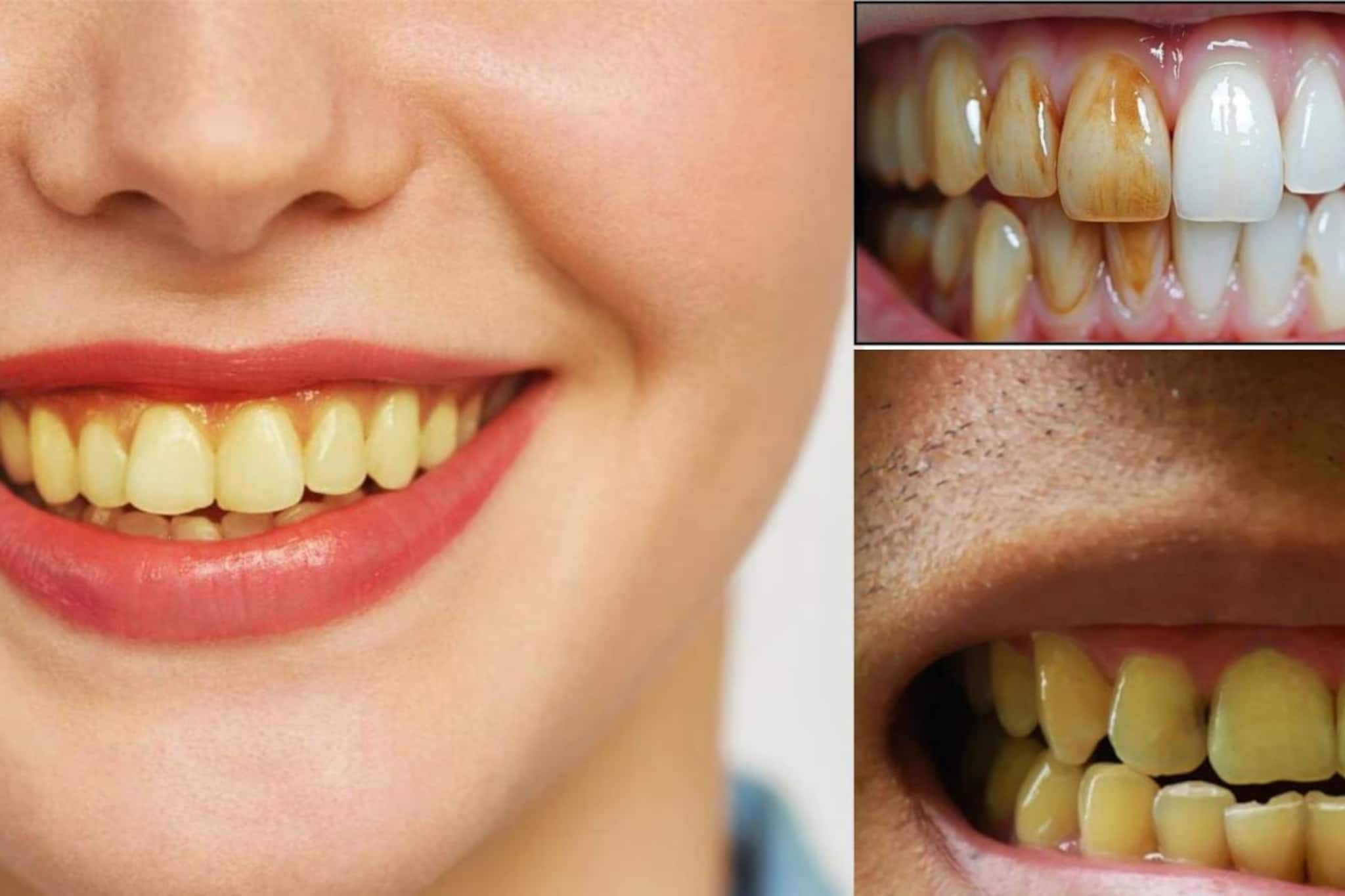 রোজ ২ বার মেজেও দাঁতে হলুদ ছোপ? দায়ী এই ‘৪’ কারণ! এখনই জানুন এবং সতর্ক হোন